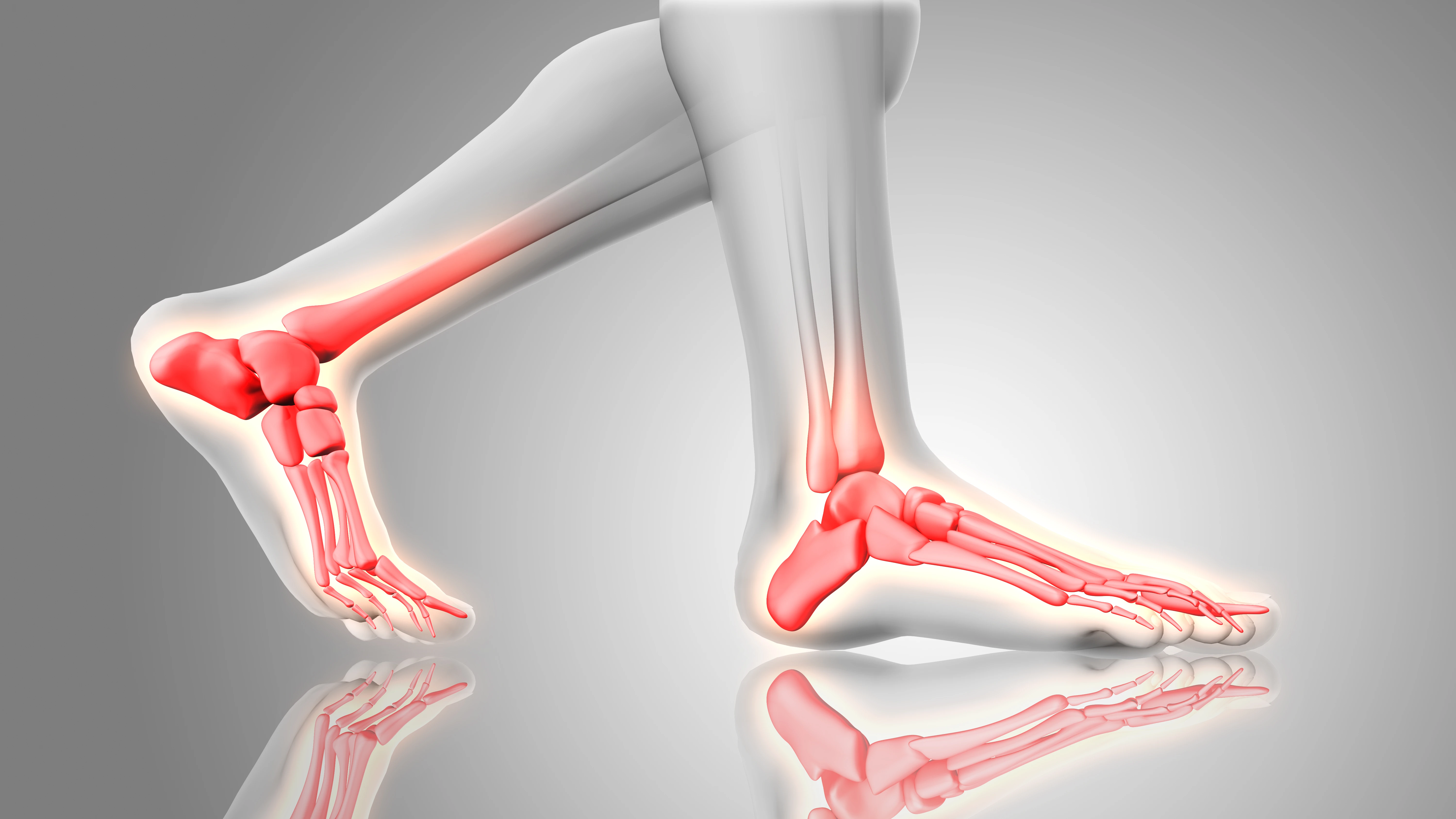 Подагра или «болезнь королей»