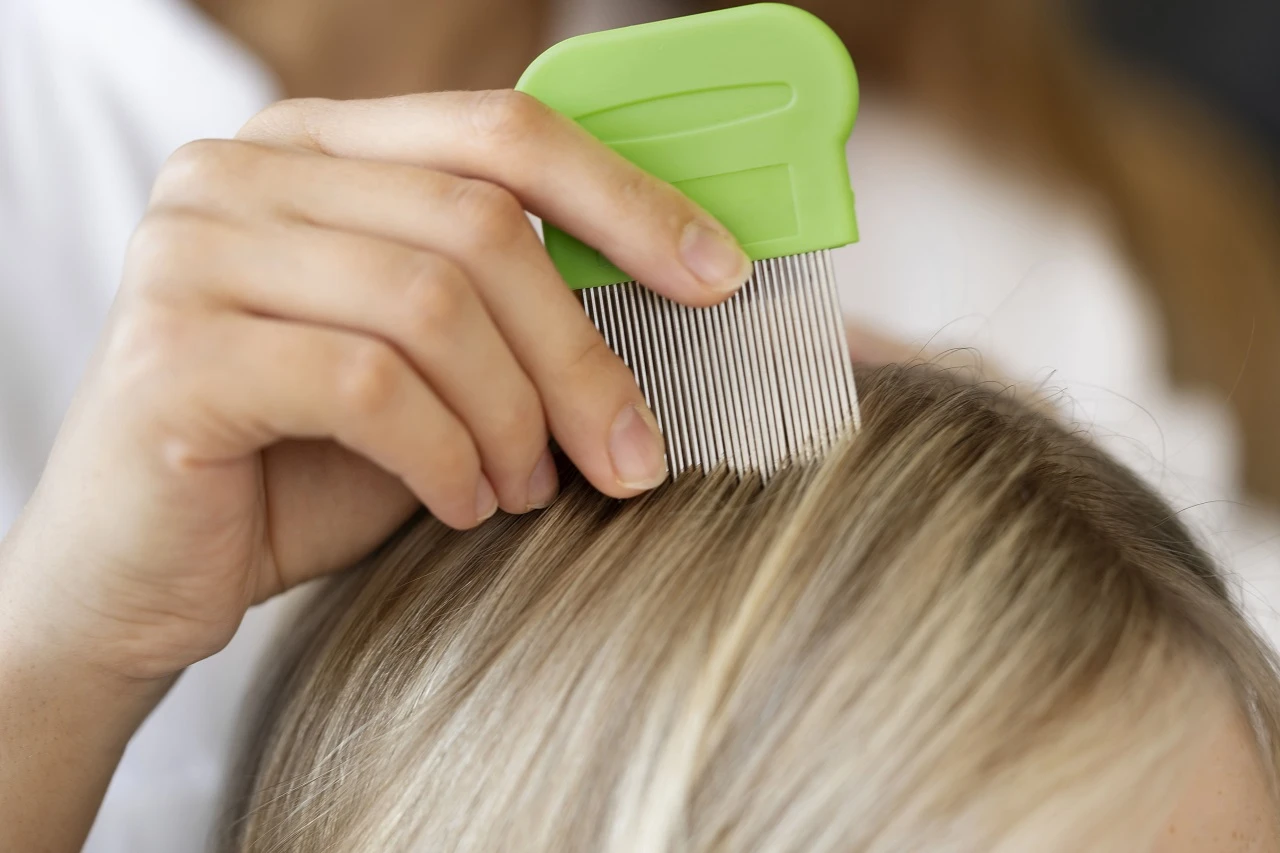 Вши — это не стыдно: как избавиться от педикулеза