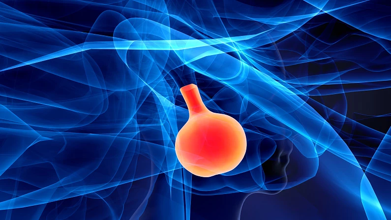 Аденома предстательной железы